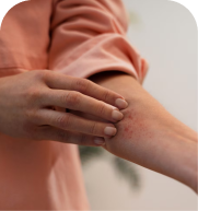 Tick bites treatment